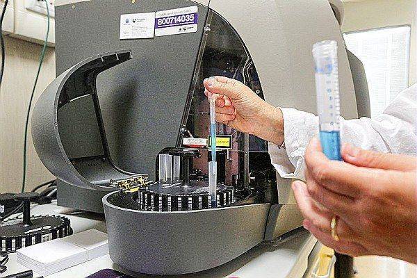 Coronavirus, l'aggiornamento: in Emilia Romagna su 17.200 tamponi effettuati 2.172 nuovi positivi 
