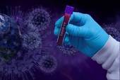 Coronavirus, l'aggiornamento nazionale: al momento ci sono 477.969 positivi